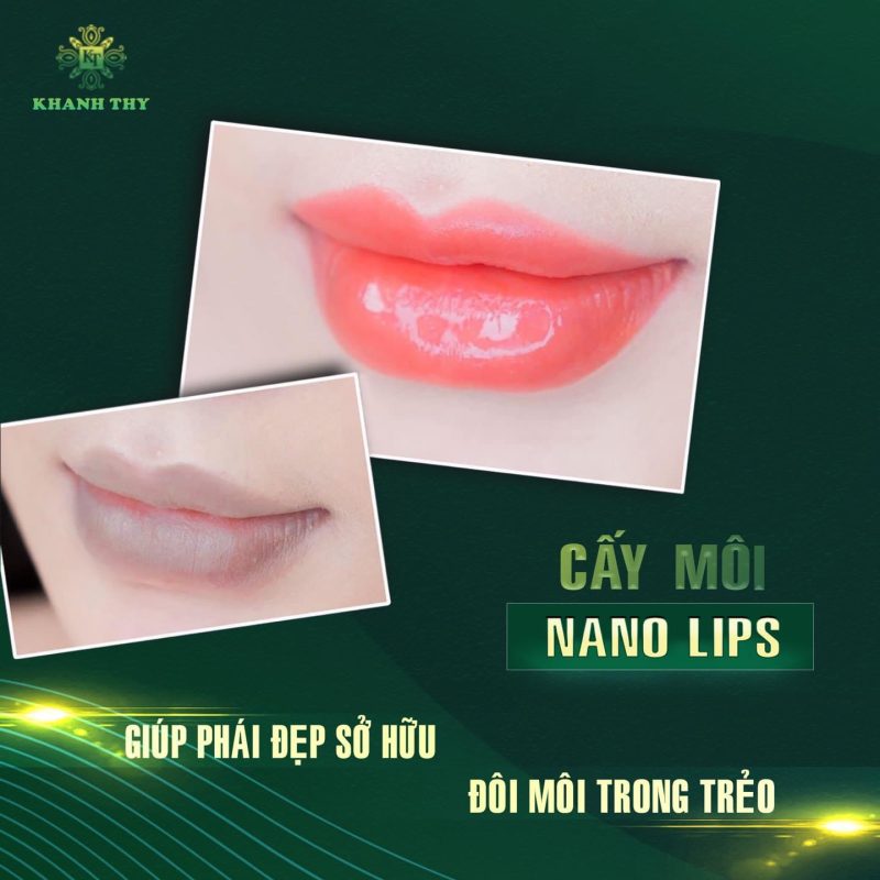 Cấy môi Nano lips